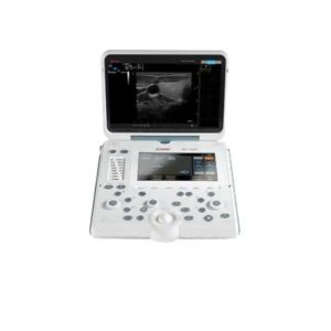 PLACAS ULTRASSOM ESAOTE MYLAB ALPHA
