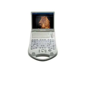 POWER SUPPLY ULTRASSOM ESAOTE MYLAB 25 GOLD