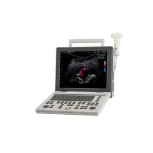 ULTRASSOM PORTATIL MEDISON SONOACE R3