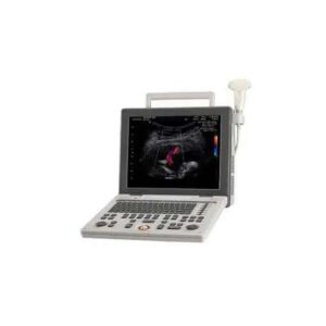 ULTRASSOM PORTATIL SAMSUNG MEDISON SONOACE R3