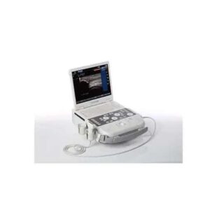 ULTRASSOM PORTATIL SIEMENS ACUSON P300