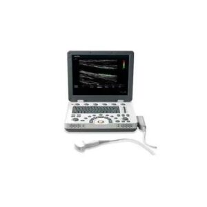 ULTRASSOM PORTATIL MEDISON MY SONO U6