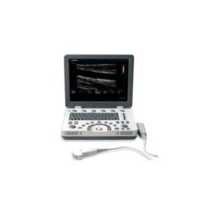 ULTRASSOM PORTATIL SAMSUNG MEDISON SONOACE U6