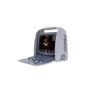 ULTRASSOM PORTATIL SIEMENS ACUSON CYPRESS PLUS